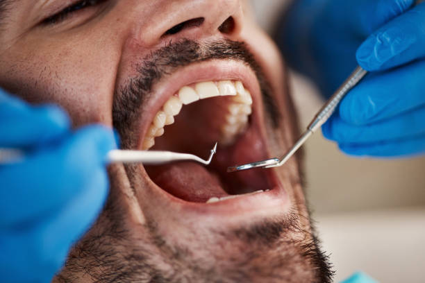 Best Periodontal (Gum) Disease Treatment  in Pittsboro, NC